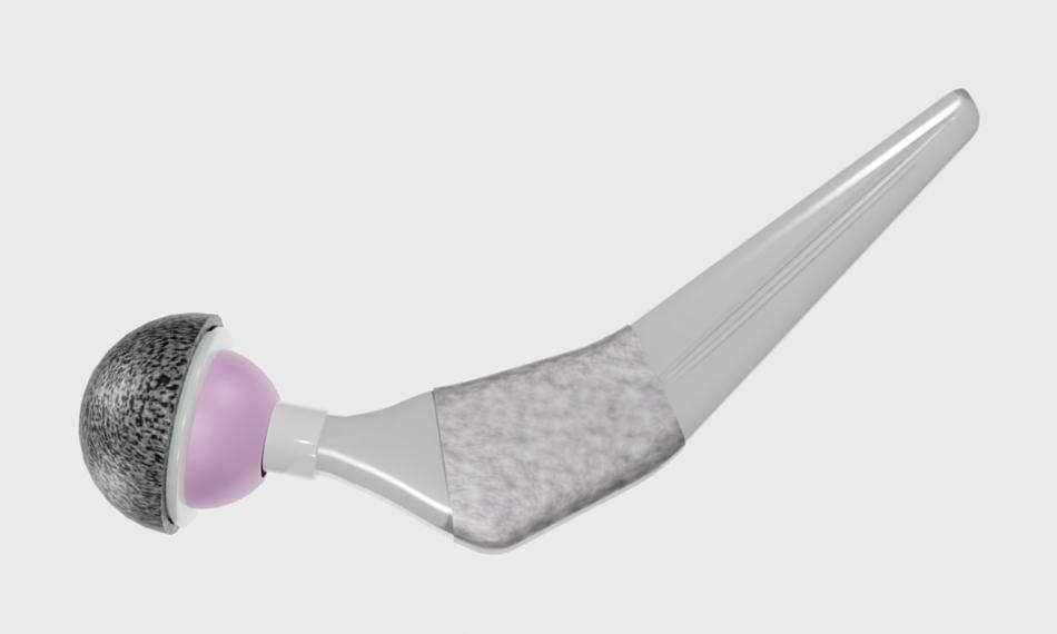 Coherent kündigt Lösung für die Oberflächenstrukturierung von medizinischen Implantaten an