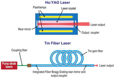 Fiber lasers, explained by RP; rare-earth doped, high power