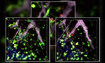 In vivo two-photon imaging of “T cell antigen recognition” reveals the key role played by random T cell motility in initiating adaptive immune responses. T cells (red) in the cervical lymph node migrate away from high endothelial venules(pink) and make random contacts with dendritic cells (green, zoomed view).